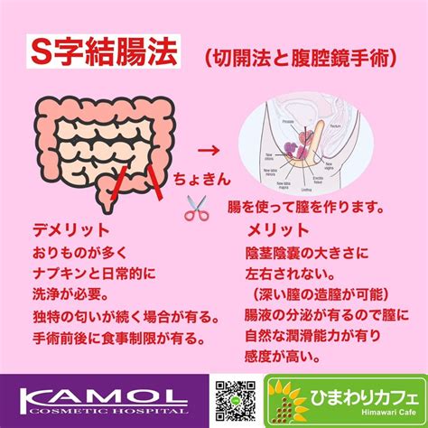 性転換大腸法|性別確認手術 あなたの性別を確認する手術 